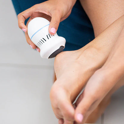 SoftSteps – Pies de Seda Callos Fuera en Minutos✨👣