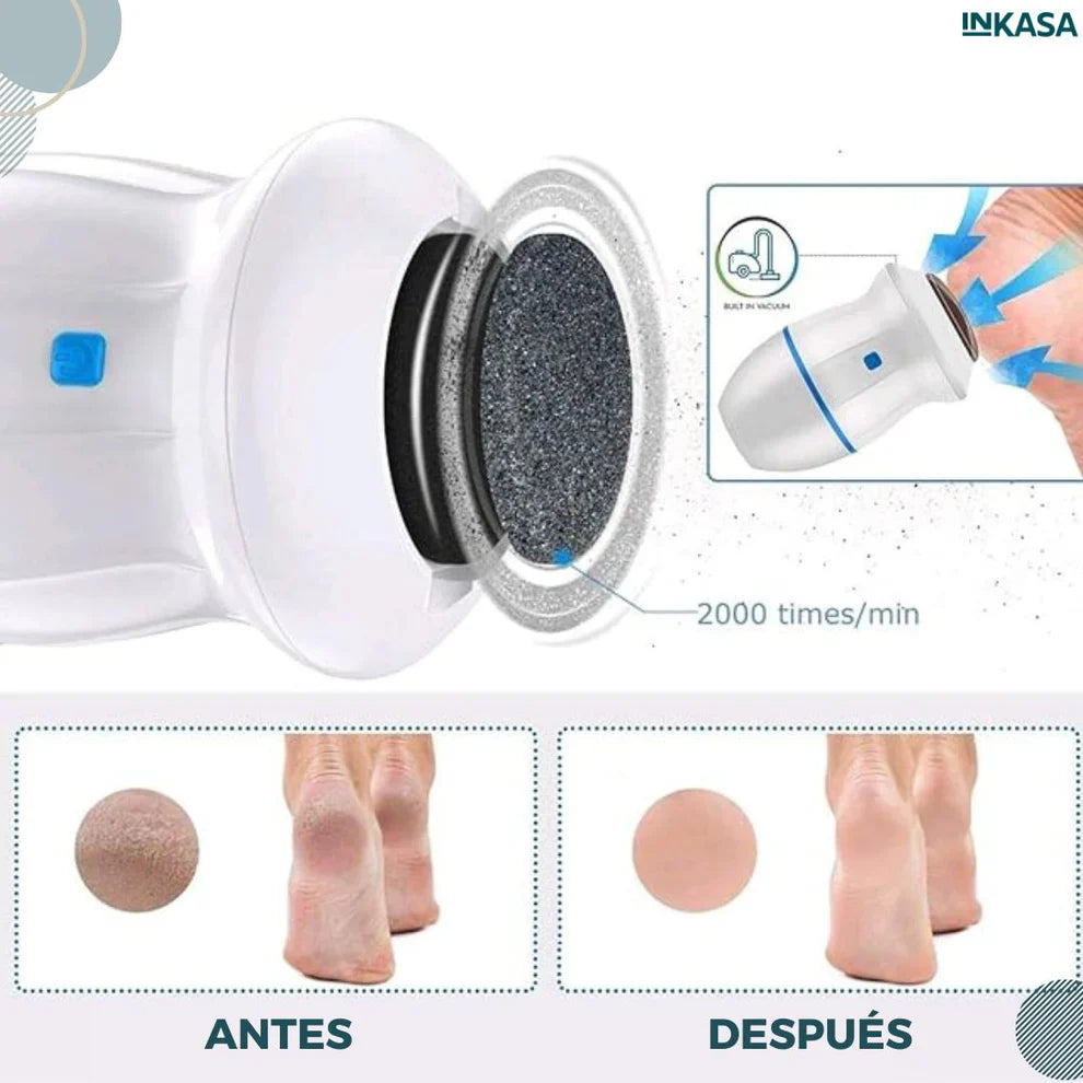 SoftSteps – Pies de Seda Callos Fuera en Minutos✨👣