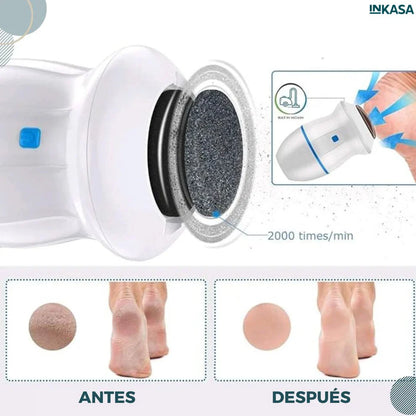 SoftSteps – Pies de Seda Callos Fuera en Minutos✨👣