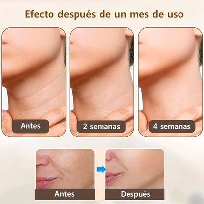 Masajeador facial multifunción Beauty Face™ | Reduce Arrugas Papada y Manchas